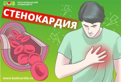 Самый  распространённый  симптом ишемической болезни сердца